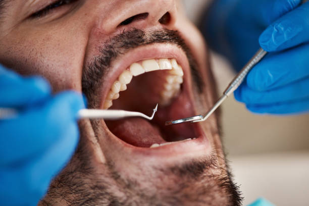 Best Urgent Tooth Repair  in Salem, AR
