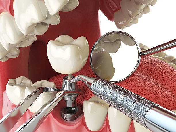 Best Knocked-Out Tooth Emergency  in Salem, AR