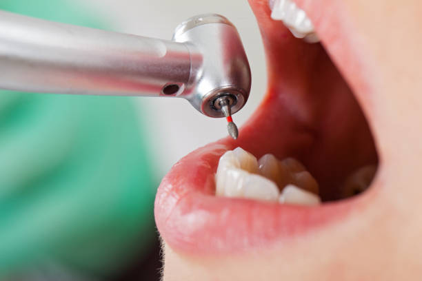Best Emergency Gum Pain Relief  in Salem, AR